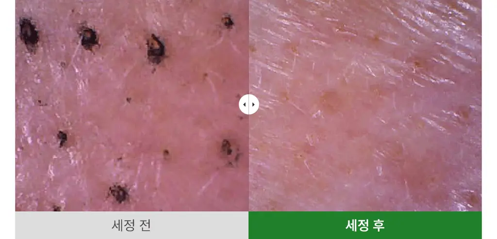 [증정기획]아리얼 애플사이다 클렌징오일 기획(200ml+100ml) 상세페이지 26